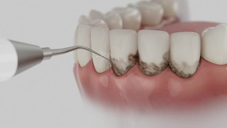 Reliable Dental Implants contractor in Camden, AR by Smile Center Dentistry